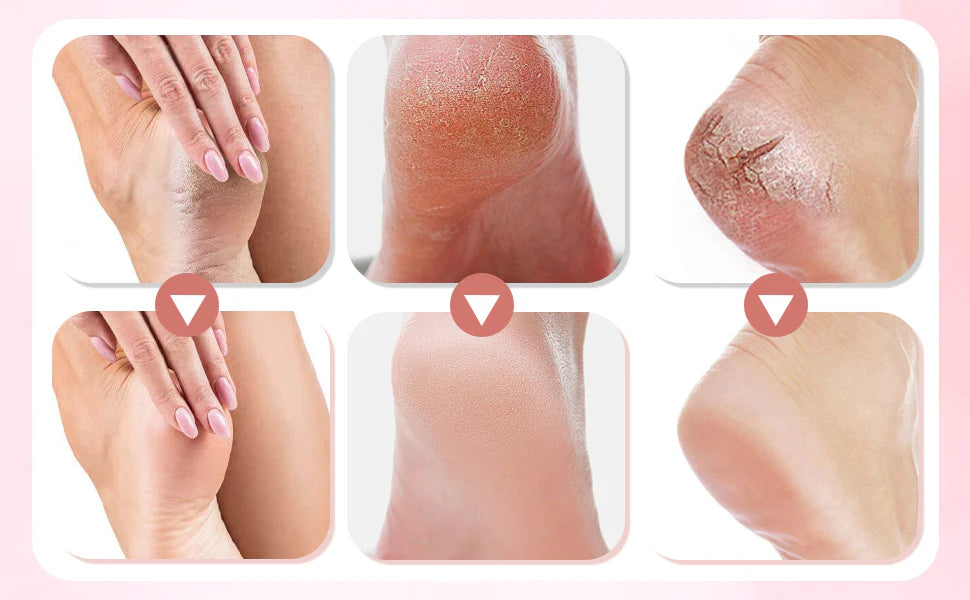✨ Ponceuse Électrique Rechargeable pour Pieds - Pédicure Maison