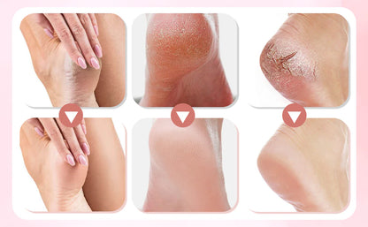 ✨ Ponceuse Électrique Rechargeable pour Pieds - Pédicure Maison