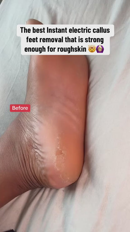 ✨ Ponceuse Électrique Rechargeable pour Pieds - Pédicure Maison